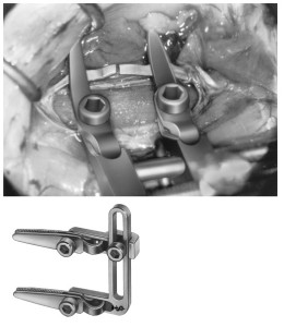 AE-FD575R, APPROXIMATOR complete