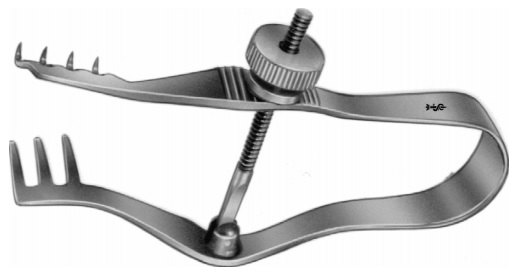 AE-BV005R, FINSEN 	SELF RETAINING RETRACTOR 	 	70 mm, 2 3/4" 