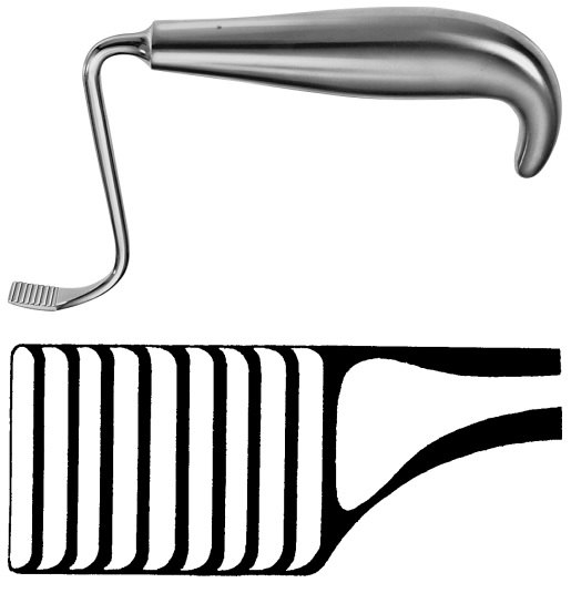 AE-DO417R, TESSIER RETRACTOR MAXILLARY MOBILIZER RIGHT 150 mm, 6" 