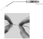 AE-OG960R, WULLSTEIN, SUCTION CANNULA SET, CONSISTING OF OG961R-OG964R, 6 - 8 mm DIAMETER, SET, CONSISTING OF OG961R - OG964R